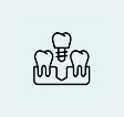 Mini-Implantate stabile Zahnprothese